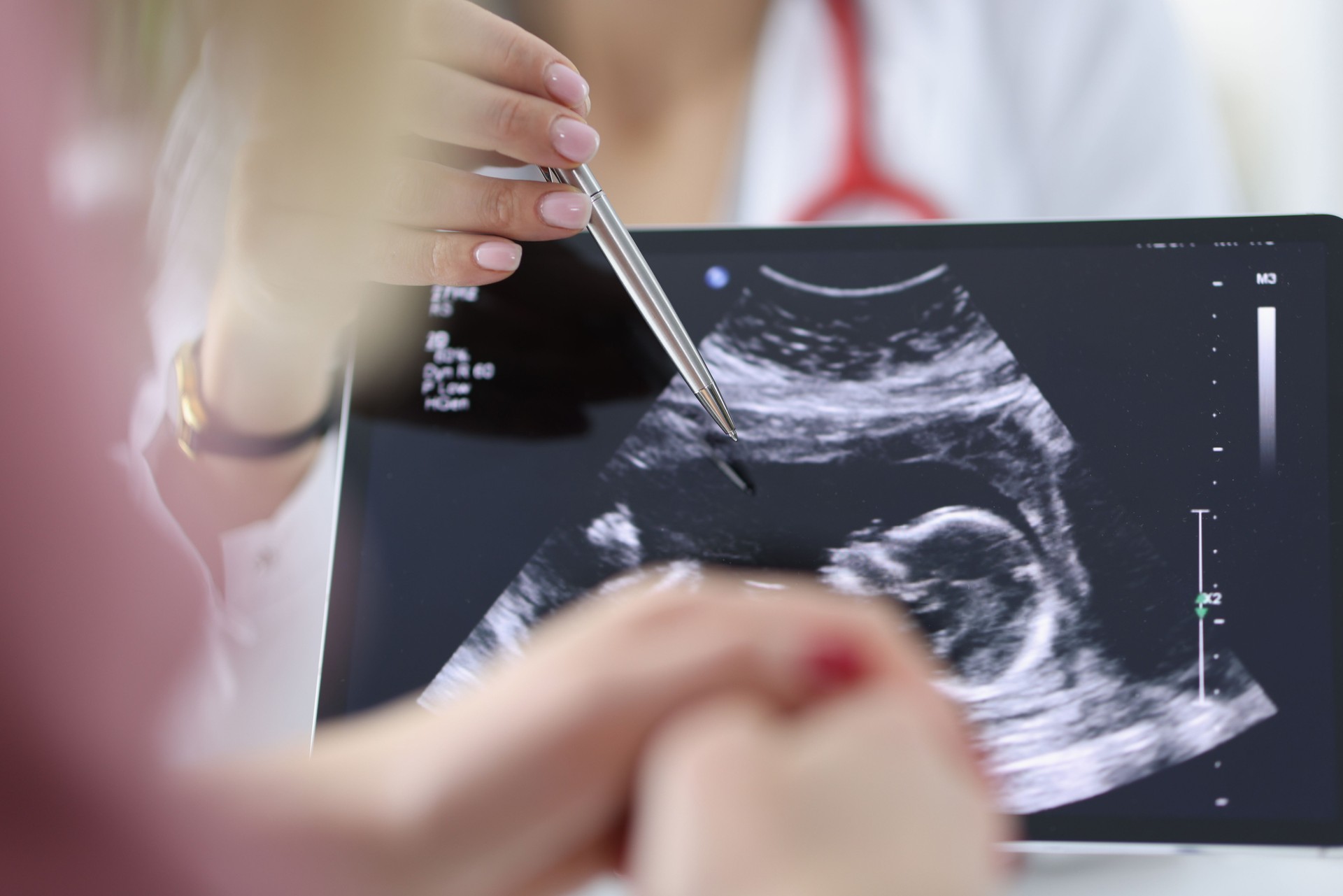 Doctor shows pregnant woman an ultrasound scan of fetus.