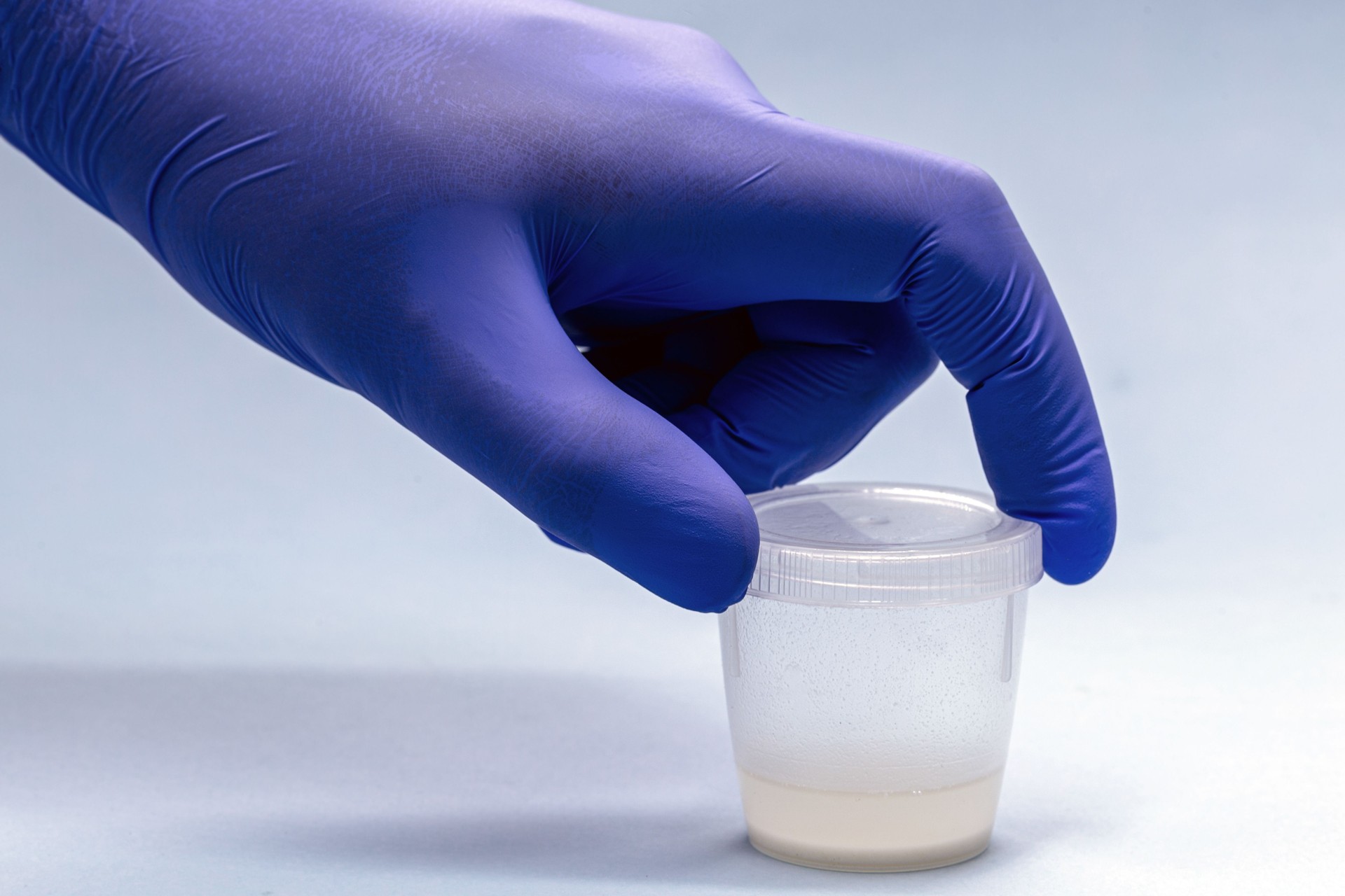 hand wearing nitrile glove holding semen or sperm sample collection container, semen donation concept