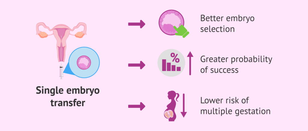 why single embryo transfer
