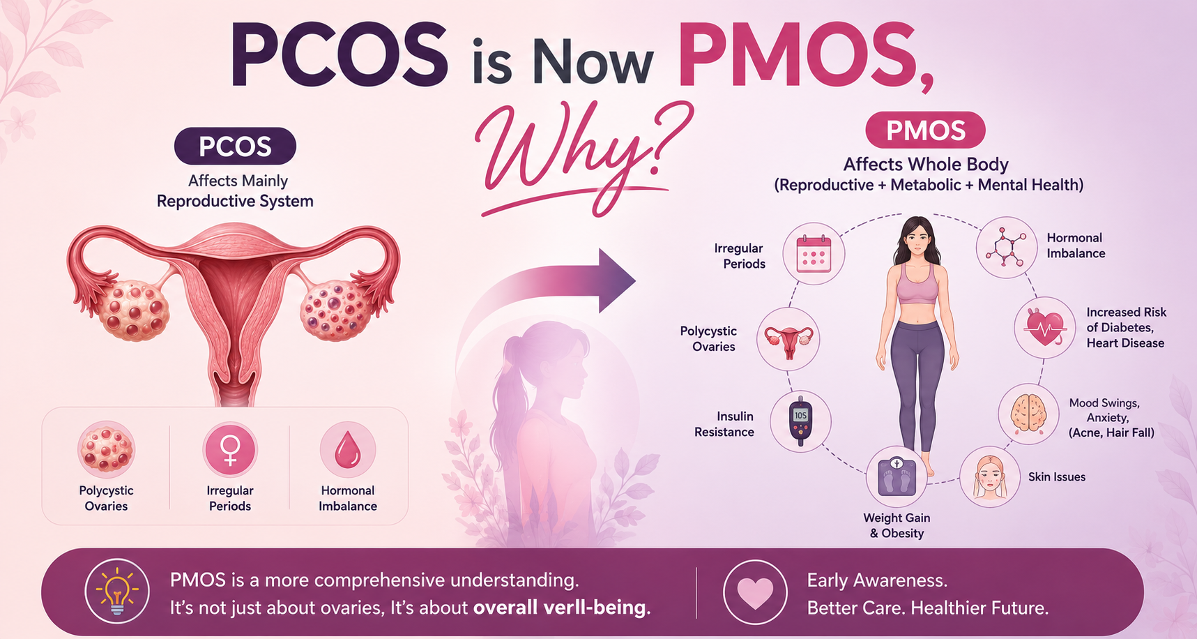 PMOS Explained: Why Doctors Are Changing the Way They Treat PCOS
