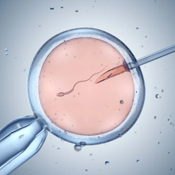 best icsi treatment